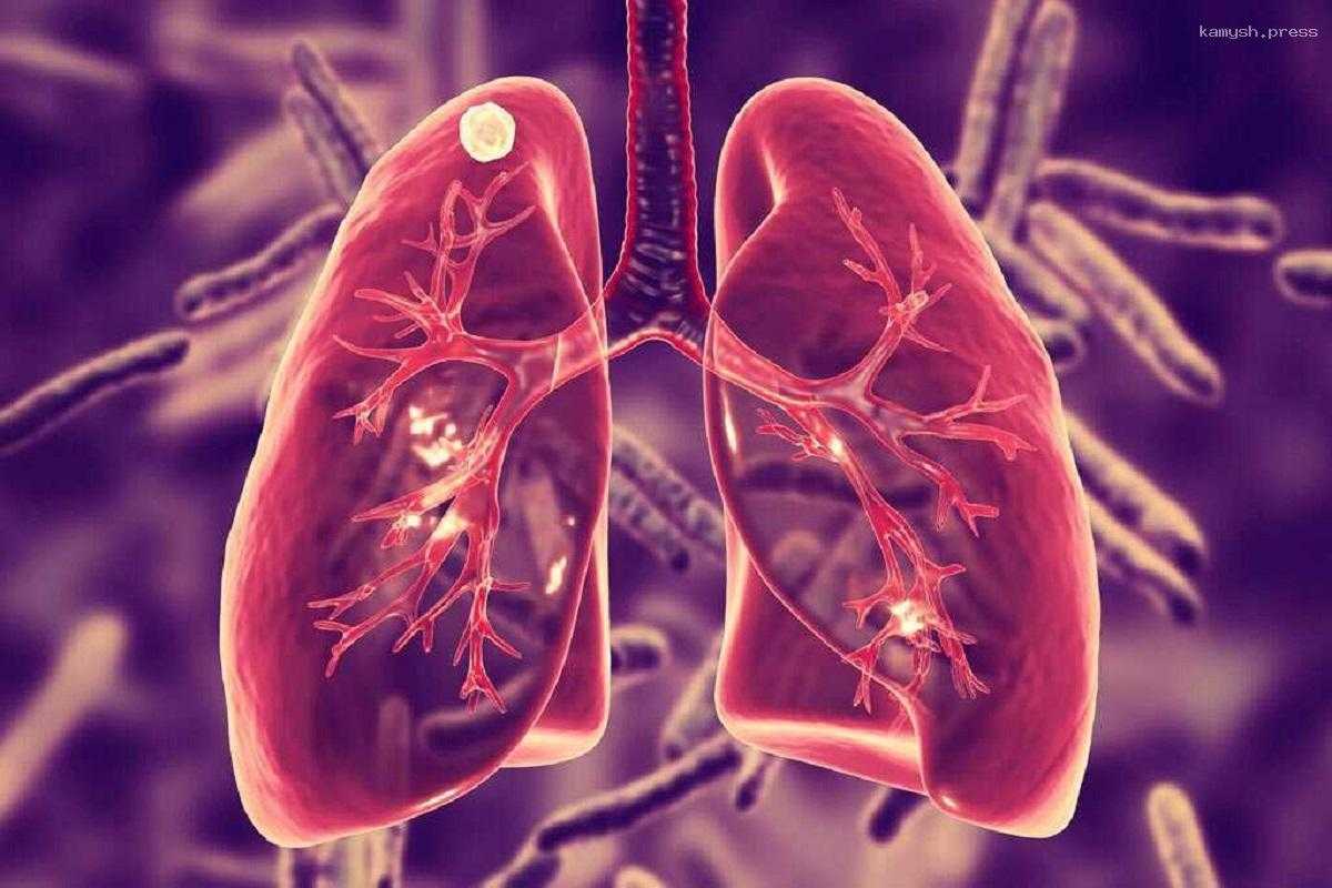 Российские ученые разработали перспективный препарат на основе уникальной молекулы для борьбы с туберкулезом