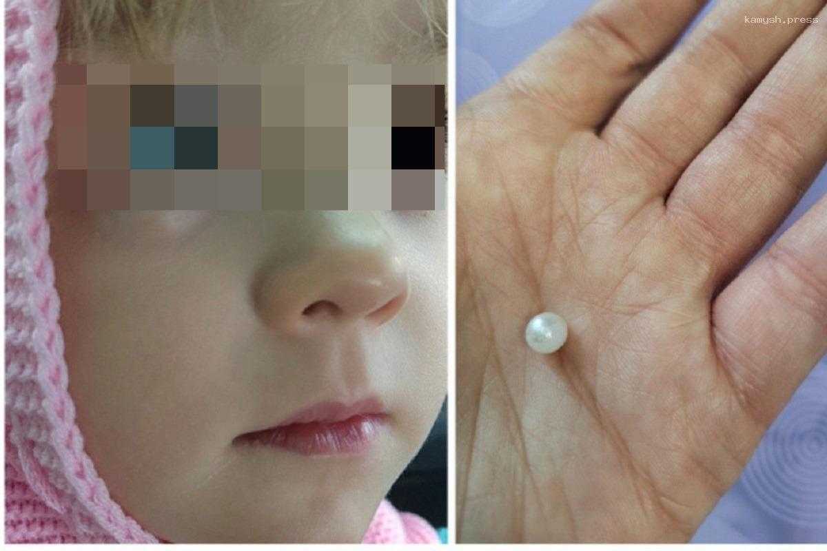 В Бурятии врач оперативно спасла зрение 3-летнему ребенку, затолкавшему в глаз бусину