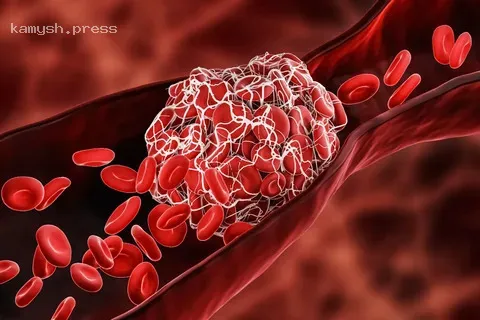 Волгоградские ученые разработали более эффективное и безопасное средство от тромбоза, чем аспирин
