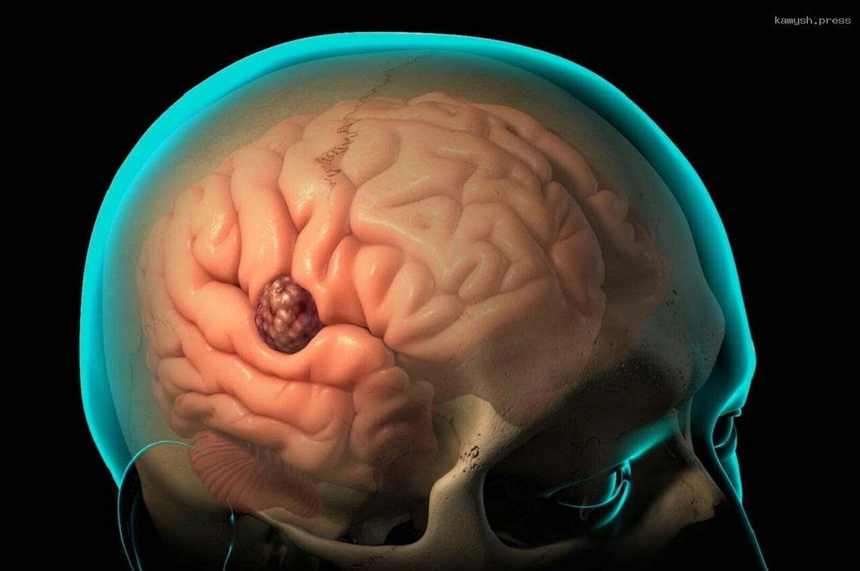 Российские ученые создали новый краситель для маркировки опухолей мозга, впереди получение патента и доклинические испытания