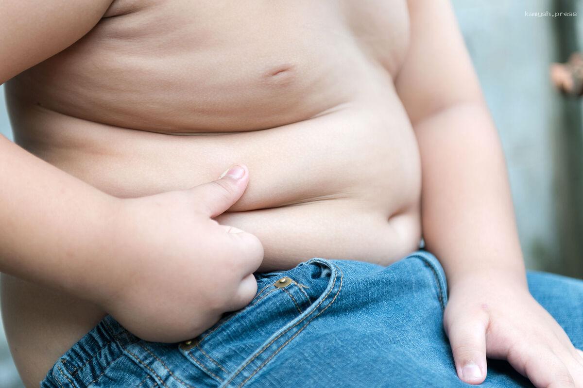 Диетолог Хайкина предупредила о последствиях ожирения у детей