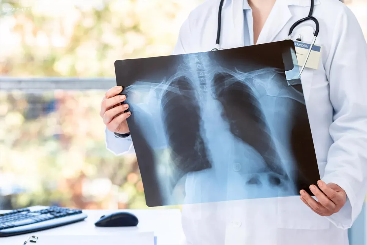 Пациентов с туберкулезом в Новосибирской области стало меньше на почти 30%