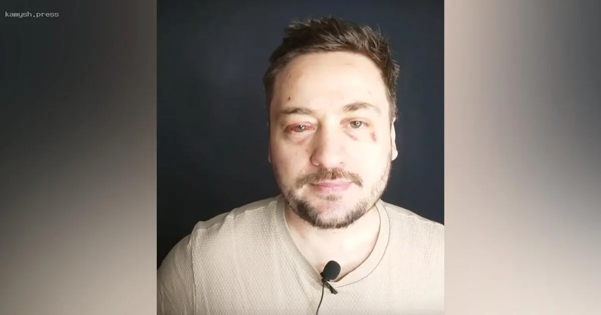 Актер Руслан Алдонин, звезда «Беспринципных» и «Слепой», стал жертвой нападения и грабежа в центре столицы