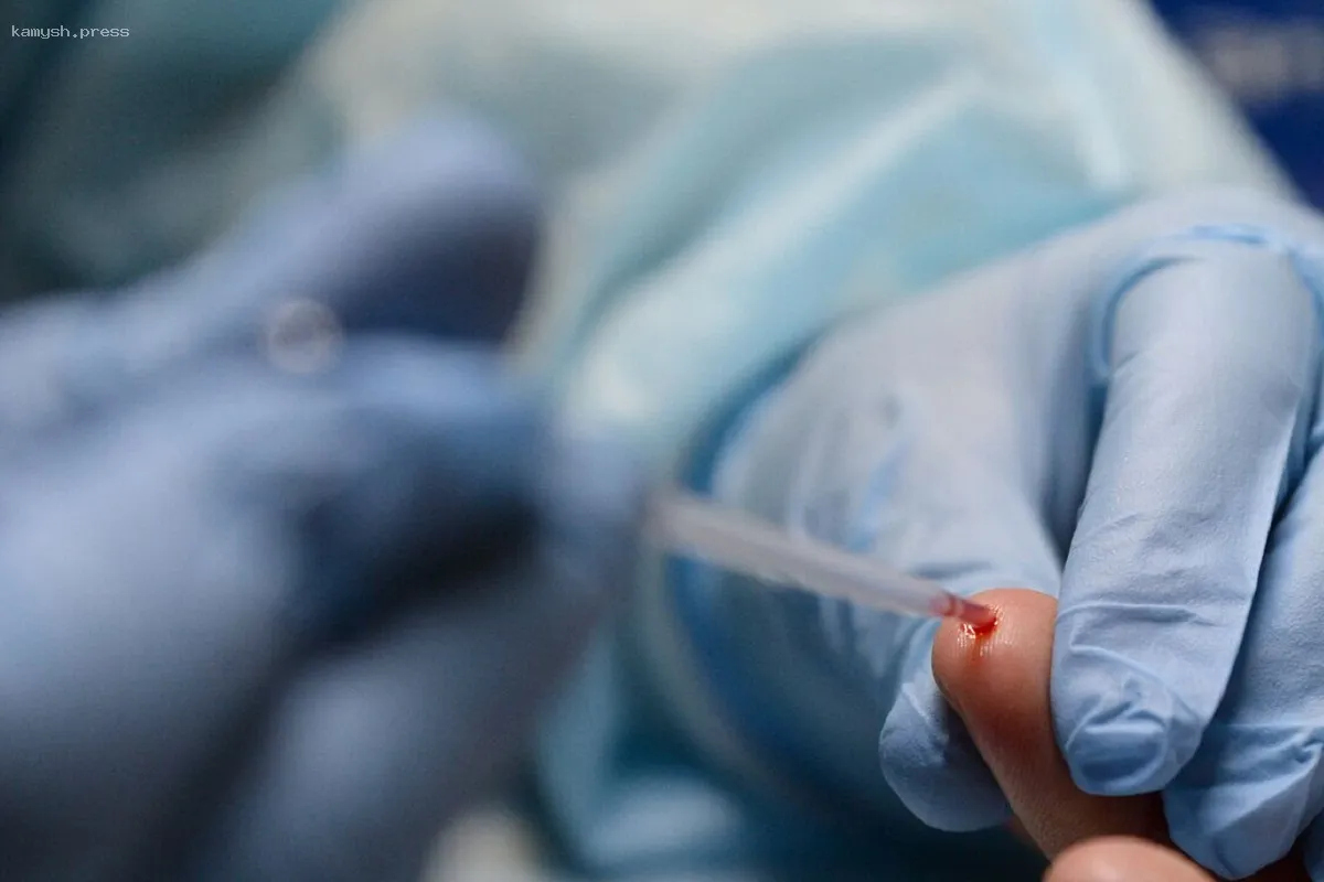 Доктор Бережная объяснила, как отличить вирусные инфекции от бактериальных по результатам анализа крови