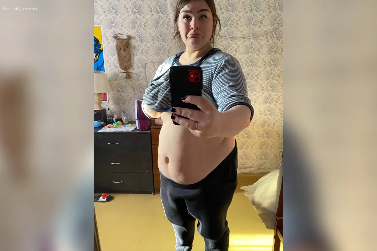 Похудела на 60 кг и отказалась от веществ. Как блогеру Ксении Шап удалось победить пороки