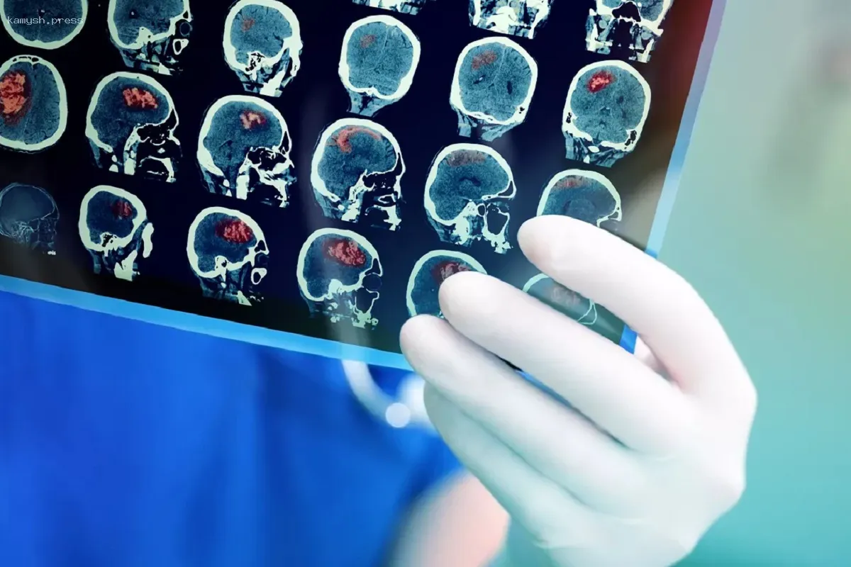 Доктор Мясников объяснил, как предотвратить инсульт