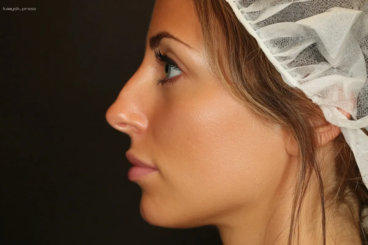 Ринопластика: как преобразование носа меняет жизнь к лучшему