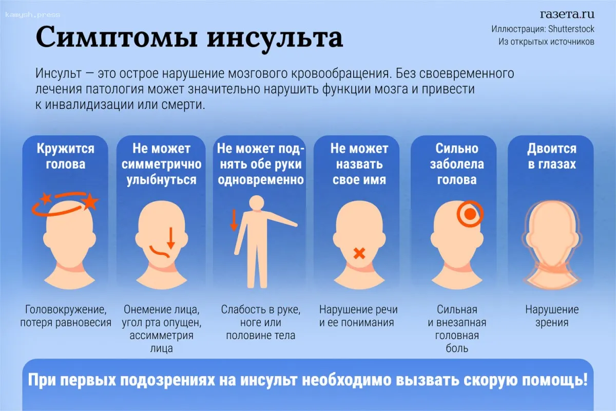 Врач Филатова высказалась о новом препарате для реабилитации после инсульта