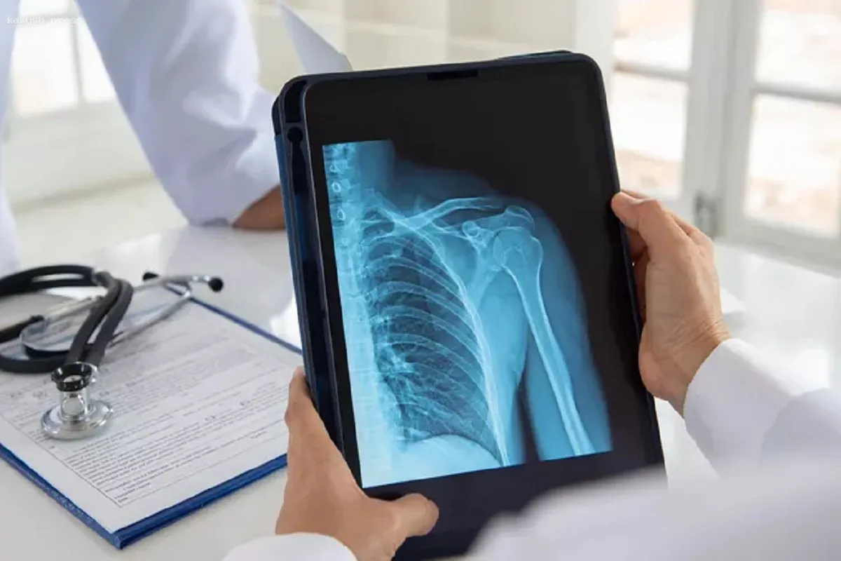 Терапевт Кондрахин рассказал, почему остеопороз чаще поражает женщин